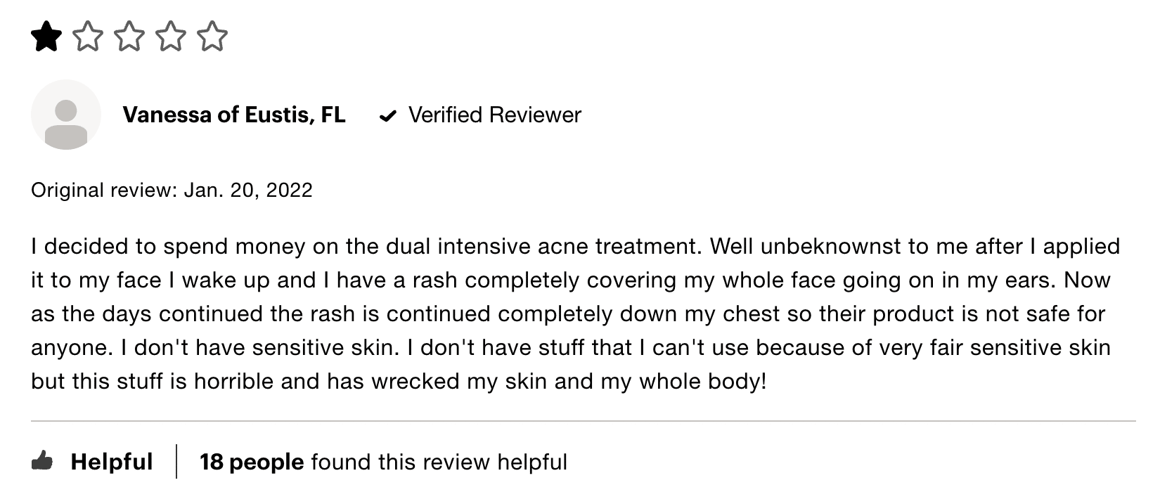 Rodan + Fields customer review